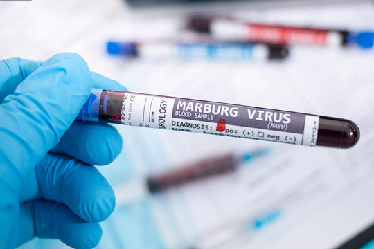 Tăng cường giám sát phòng, chống dịch bệnh Marburg
