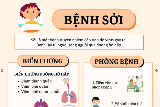 Quảng Nam chỉ đạo tăng cường phòng, chống bệnh sởi